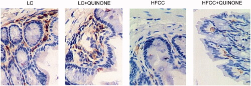 Figure 5. IHC was conducted to test the levels of GLP-1 in LC group, LC + tocopheryl quinone group, HFCC group and HFCC + tocopheryl quinone group. The treatment with HFCC and tocopheryl quinone increased and decreased the levels of GLP-1, respectively (n = 3, the brown as arrow-pointed denotes the expression of GLP-1).