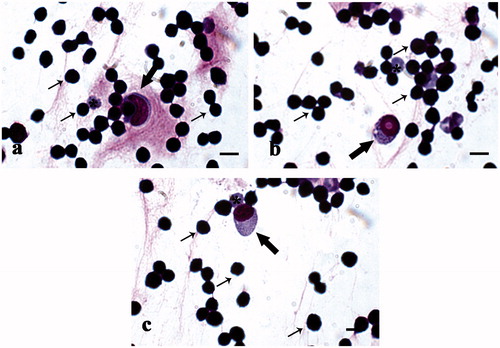 Figure 8. MGG-Quick rapid staining of leukocytes isolated from peripheral blood: (a–c) lymphocytes (thin arrows), monocytes (thick arrows), and rare red blood cells (*). Scale bars: 10 µm (a–c).