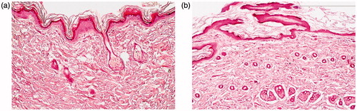 Figure 4. Photomicrographs showing histopathological sections (hematoxylin and eosin stained) of (a) normal untreated rat skin and (b) rat skin treated with optimal PMMs formulation (F7).