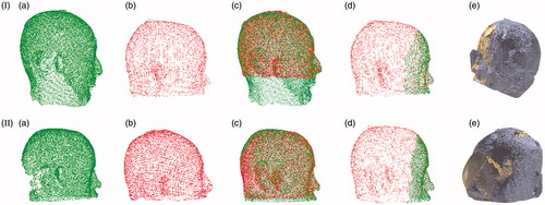 Figure 6. Clinical registration using the proposed method and a previously described 4PCS method [Citation3,Citation16]. I and II indicate patients one and two, respectively. (a) Point cloud from the real-patient surface. (b) Point cloud from MRI. (c) Full head registration. (d) Facial registration. (e) Failed facial registration using the 4PCS method. The real-patient point cloud is golden; MR image point cloud is gray. (color online).
