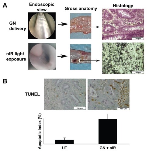 Figure 2 Mucosal ablation in the esophageal lumen as a result of loading with gold nanoparticles and exposure to near infrared light. (A) Delivery of gold nanoparticles and exposure to near infrared light in the esophageal lumen. Gross anatomy and histology in the ablated area is shown. (B) Apoptosis associated with thermal ablation in the adjacent tissue after exposure to near infrared light.Abbreviations: UT, untreated; GN +nIR, gold nanoparticles treated with infrared light.