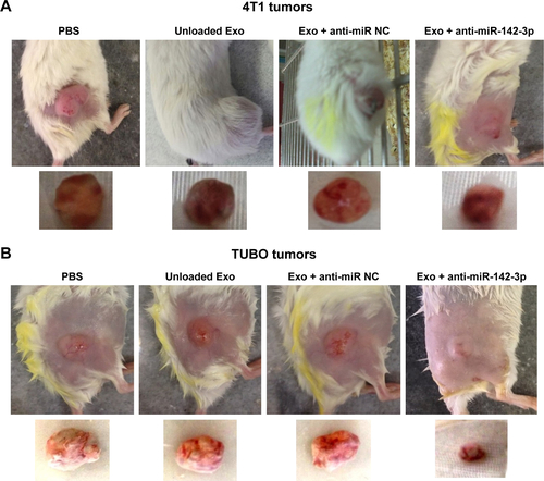 Figure S3 Anti-tumor effects of in vivo delivery of LNA-anti-miR-142-3p via MSCs-Exo.Notes: (A) Representative images of female BALB/c mice bearing 4T1 breast tumor and excised tumor tissues at the end of day 36. (B) Representative images of female BALB/c mice bearing TUBO breast tumor and excised tumor tissues at the end of day 40.Abbreviations: Exo + anti-miRNC, exosomes loaded with LNA-anti-miRnegative control; Exo + anti-miR-142-3p, exosomes loaded with LNA-anti-miR-142-3p; MSCs-Exo, mesenchymal stem cells-derived exosomes; LNA, locked nucleic acid.