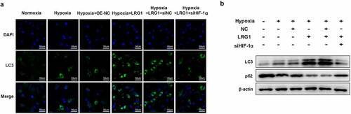 Figure 7. siHIF-1α reversed the effect of LRG1 on autophagy in H9c2. (a) Autophagy was detected by immunofluorescence assay (the scale bars = 50 μm); (b) LC3 and p62 protein expression were detected by western blot