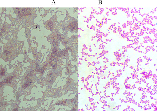 Figure 1 Gram staining (A) and Koch staining (B) features of the strains in the present study.