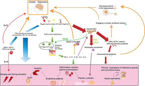 Figure 1 Schematic diagram of possible overlap mechanisms between rosacea and anxiety and depression.