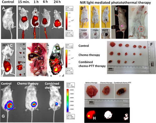 Figure 7 In vivo performance of GOF-Lip-FA nano theranostic platform. (A–C) in vivo 4T1 cancer diagnosis and distribution of nano theranostic systems by near-infrared fluorescence imaging. (D–E) images of the tumor-bearing animal under laser irradiation and tumor size shrinkage shown in dotted circles. (F) Tumor size after different therapeutic paths. (G) The decrease in tumor size after 21 days. (H) near-infrared fluorescence images of tumor regression after various treatments.Note: Copyright ©2019. American Chemical Society. Reproduced from Prasad R, Yadav AS, Gorain M, et al. Graphene Oxide Supported Liposomes as Red Emissive Theranostics for Phototriggered Tissue Visualization and Tumor Regression. ACS Applied Bio Materials. 2019; 2 (8): 3312–3320.Citation168