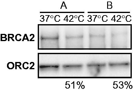 Figure 5. Tumour heterogeneity contributes to pre-hyperthermia protein levels of BRCA2 in cervical tumours. Immunoblots of two biopsies (A and B) taken from the same cervical tumour and treated ex vivo in the same hyperthermia-session at 42 °C. Upper panel shows the BRCA2-signal, the lower ORC2. The percentages at the bottom of the panel indicate the relative intensity of the BRCA2 signal (corrected to ORC2) in the heat-treated sample compared to the non-treated sample for each biopsy.