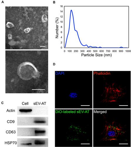 Figure 1 Characterization of sEV-AT. (A) Representative images of sEV-AT with transmission electron microscopy. Scale bar=100 nm. (B) The particle size distribution of sEV-AT was measured by ZataView analysis. (C) Western blot analysis of exosomal markers, CD63, CD9, and HSP70. Actin was cellular protein as a control. (D) Uptake analysis of sEV-AT by HUVECs (red: phalloidin, green: DiO-labeled sEV-AT, blue: nuclei). Scale bar=20 µm.