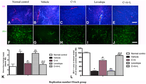 Figure 6 (A–E) C16+Ang-1, but not levodopa, reduced BBB permeability and blood vessel leakage. EB leakage showed by red colour. (F–J) Tight junction between microvascular endothelial cells, shown by immunofluorescence staining of ZO-1 (green), were reduced in the vehicle group, but maintained by C16+Ang-1 treatment. (K) Quantification of EB. (L) Quantification of ZO-1. Scale bar = 100 µm. a, P < 0.05 versus control; b, P < 0.05 versus vehicle group; c, P < 0.05 versus C16+Ang-1 treated group; d, P < 0.05 versus levodopa-treated group.