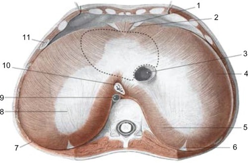 Figure 1 The area above the diaphragm: the dotted line for the support of heart 3: inferior vena cava; 10: esophagus; 9: aorta; 8: tendinous center; 5: lumbar area.AA VV, Anatomia dell’uomo, 4 ed, Edi.ermes, Milano [Several authors, Human Anatomy, Fourth Edition, edition EdiErmes]. www.eenet.it.