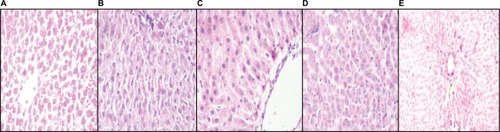 Figure 8 Histopathological section of liver.