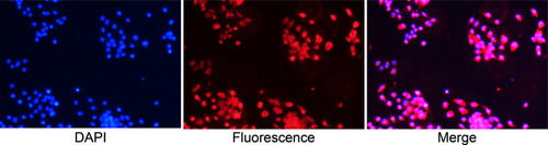 Figure 2 Identification of basal epithelial cells acquired from mouse prostate with anti-p63 in immunofluorescence assay (Objective 10X). Basal epithelial cells were specific to anti-p63 and more than 90%.