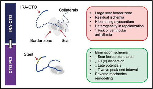 Figure 2. Schematic overview of pro-arrhythmic effects of IRA-CTO and potential beneficial effects of CTO PCI.