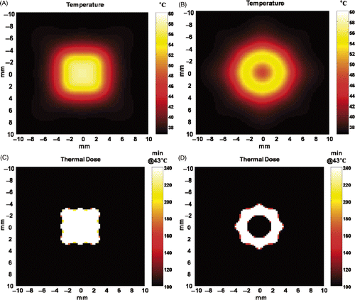 Figure 11. An application example of anti-focus. (A) A simulated temperature distribution computed 8 seconds after alternating insonification of 20 m/s for Field I and Field II for a total duration of 2.8 s. (B) A simulated temperature distribution computed 8 seconds after alternating insonification of 20 m/s for Field III and Field IV for a total duration of 2.8 s. The peak pressure amplitude is 5 MPa in all four cases. (C) The accumulated thermal dose of (A) and (D) is the accumulated thermal dose of (B).