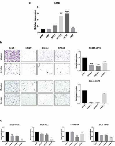 Figure 9. Validation of ACTB mRNA expression and function in HNSC. Normal head and neck cell lines include HOK and NOK and HNSC cell lines include SCC9, SCC25, CAL33 and H400. * P < 0.05; ** P < 0.01; ***P < 0.001; ****P < 0.0001. (a) Comparison of ACTB mRNA expression between normal head and neck and HNSC cell lines. (b) Knockdown of ACTB restrained cell migration and invasion in SCC25 and CAL33 cells. (c) Knockdown of ACTB decreased the expression of NFKB1, RELA, RHOA and CTNNB1