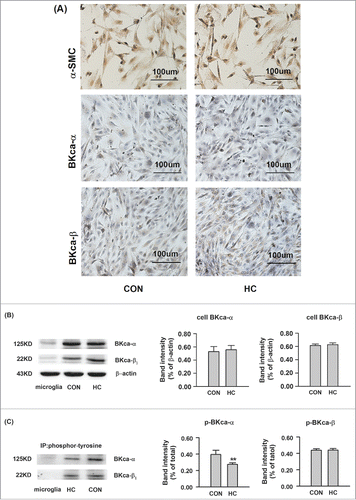 Figure 3. The protein expression of BKCa channels in SOSMCs in the control and HC groups. (A) Representative immunohistochemically staining of α-SMC, BKCa α- subunits, and BKCa β1-subunits in SOSMCs. Magnification, ×200. (B) Western blot analysis showing the total protein expression of BKCa α-. and β1-.subunits. (C) The protein expression of Tyr-phosphorylated BKCa α-. and β1-.subunits. The proteins were immunoprecipitated with antibodies against phosphorylated BKCa α- and β1-subunits and detected with Western blot. CON: SOSMCs from control group rabbits; HC: SOSMCs from hypercholesterolemia group rabbits; Microglial cells used for negative control. n = 5. **p < 0.01, HC vs control.