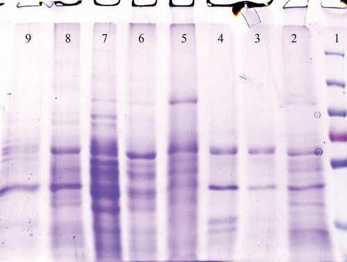 Figure 5. The SDS-PAGE of the P. pastoris GS115/pPICZαA-EBV cells revealed a protein band profile with a molecular mass of ~50 kDa. EBV protein was not found in the P. pastoris GS115/pPICZαA cells. Line 1: Protein ladder, Line 2–4: pPICZαA with EBV fusion peptides and Line 5: pPICZαA without fusion peptide.