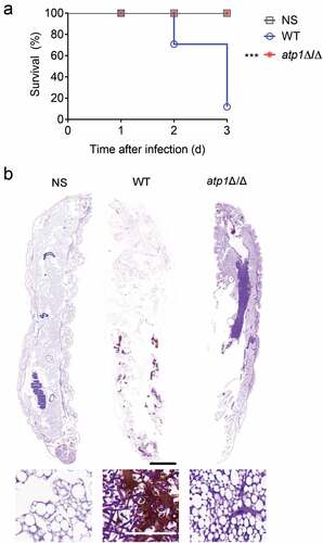 Figure 1. Deletion of the F1Fo-ATP synthase α subunit abrogates the inflammatory response in G. mellonella. (a) After injection of 100 μl NS, WT or atp1δ/Δ (5 × 105 CFU per larva), the survival curves of G. mellonella (n = 12) were obtained and analysed by log-rank tests. ***P < 0.001. (b) Seventy-two hours after injection of 100 μl NS, WT or atp1δ/Δ (5 × 105 CFU per larva), the sections of G. mellonella (n = 3) were stained by PAS. Scale bars, 2000 µm (top), 50 µm (bottom). These images represent the results of one of three separate experiments.