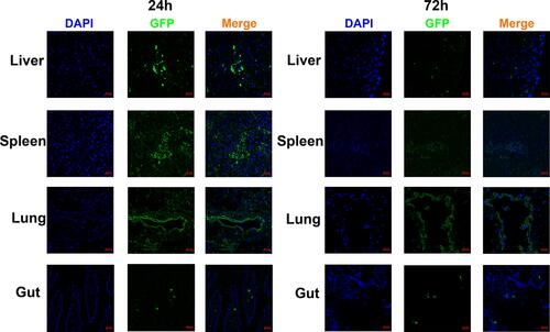 Figure 3 Human amnion mesenchymal stem cells migrated to target organs. GFP-labeled hAMSCs detected by confocal microscopy in target organs at 24 after injection in vivo. At 72 h, GFP fluorescence in the spleen, liver, and gut was weakened while increased in the lung.