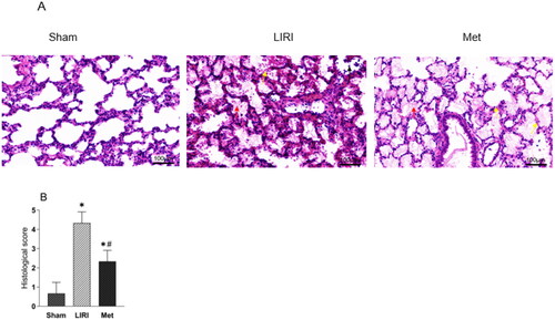 Figure 2. Metformin attenuated lung pathological injury in rats after lung transplantation (A) Representative images of H&E-stained lung tissues from rats. Many inflammatory cells were observed in the transplanted lung tissues, and severe thickening and breakage of the alveolar wall were observed. Severe edema and hemorrhage were observed in alveolar tissues in the LIRI and Met groups (magnification, 100 µm.) (B) The histological injury scores are shown. *p < 0.05, vs. the sham group; #p < 0.05, vs. the LIRI group. Display full size, sham group; Display full size, LIRI group; Display full size, Met group.