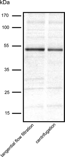 Figure 4.  SDS-PAGE of Npt1 partially purified by Ni-NTA chromatography from DDM-solubilised membranes prepared either by centrifugation or tangential flow filtration, as indicated. Protein was detected by staining with SimplyBlue™ Safestain. The positions of marker proteins of known molecular mass are shown on the left.