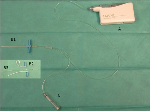 Figure 1 Microdialysis catheter.