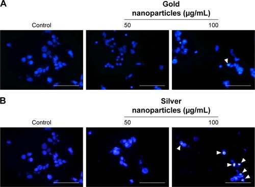 Figure 9 Cell apoptosis of BG-AuNps (A) and BG-AgNps (B) in MCF-7 breast cancer cells by Hoechst nuclear staining.Abbreviations: BG, black ginseng; AuNps, gold nanoparticles; AgNps, silver nanoparticles.