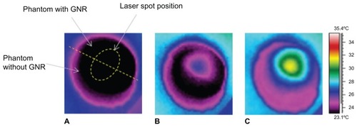 Figure 5 Thermal images of a sample made of two half-cylindrical solid phantoms joined together, one with gold nanorods and the other without. Image (A) was taken before laser irradiation. The border between the phantoms is shown by a dashed straight line. The elliptical contour shows the place where the laser beam hits the sample. Images (B) and (C) were taken after 10 seconds and 5 minutes of laser irradiation, respectively.Note: It can be seen that the temperature in the part of the sample with the gold nanorods rises compared with that in the part without gold nanorods.