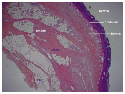 Figure 10 Low power histology sections showed that cutaneous, hypodermal, tendon, neural and vascular tissues retained their normal architectures.