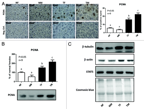 Figure 2. PCNA protein content and immunostaining. To evaluate hepatocellular proliferation, the expression of the proliferating cell nuclear antigen (PCNA) was assessed in the liver from young adult normal female (NF), normal male (NM), GH-transgenic female (TF) and GH-transgenic male (TM) mice. (A) Immunohistochemical staining of liver sections with anti-PCNA antibody: representative microphotographs are shown; the % of positive hepatocyte nuclei was determined in 10 high-power fields per mouse, nine animals per group were analyzed. Negative controls were performed in parallel on additional slides and incubated with PBS instead of primary antibody. (B) Liver extracts were analyzed by immunobloting with anti-PCNA antibody. Quantification was performed by scanning densitometry and expressed as % of the mean values in normal female mice. Data are the mean ± SEM of nine sets of different individuals per group (n). Different letters denote significant difference at p < 0.05. A representative result of immunoblots is shown. (C) Loading controls were performed by immunoblotting with anti-β-tubulin, anti-β-actin and anti-STAT5 antibodies and by staining the PVDF membrane with Coomasie blue. Each lane contains 40 μg of solubilized liver proteins from an individual animal.