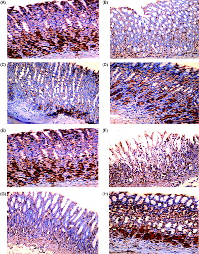 Figure 2. COX-1 expression in rat gastric mucosa. (A, E) Highly positive (+++) constitutive expression of COX-1 in gastric mucosa of Control groups 1 and 2 rats, respectively. (B) Negative (±) expression in INDO rat. (C): negative (±) expression in ranitidine + INDO rat. (D) Moderate (++) expression in fluoxetine + INDO rat. (F) Weak positive (+) expression in alcohol-only rat. (G) Negative expression (±) in ranitidine + alcohol rat. (H) Moderate (++) expression in fluoxetine + alcohol rat. Representative photomicrographs from each group are shown. (PAP; magnification = 40×).
