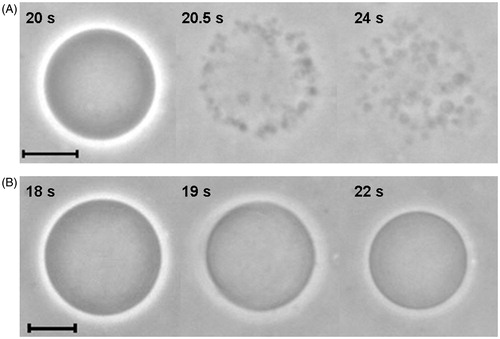 Figure 6. Sequence of images of erythro-GUVs in the presence of (A) 0.1 mM Brij 98 and (B) 0.5 mM TX-100. The time shown in each snapshot is relative to the moment when the erythro-GUVs were added to the detergent suspension. At least 20 GUVs were followed in the presence of Brij 98 and 100 GUVs in the presence of TX-100. The scale bars represent 10 μm.