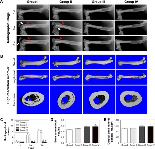 Figure 1 Radiographic images and analysis at 1 day, 3 weeks, and 6 weeks.Notes: (A) Lateral X-rays of the left femur. The red arrows indicate osteolysis and slight periosteal reactions around the distal femurs, while the white arrows indicate articular surface damage, osteosclerosis, and deformities. (B) Three-dimensional micro-CT images of the left femur at the time of sacrifice. The micro-CT evaluations of the middle femurs were confined to the red square region. (C) Radiographic scores of the X-ray images. *Denotes a significant difference compared with groups I and II (P<0.01, n=5). **Denotes a significant difference compared with group I (P<0.05, n=5). (D) Bone volume/total volume and (E) cortical bone mineral density of the selected regions of the left femurs evaluated by micro-CT. *Denotes a significant difference compared with groups I and II (P<0.01, n=5). Groups I, II, III, and IV indicate Ti + S. aureus, NT + S. aureus, NT-G + S. aureus, and Ti + PBS, respectively. Ti, titanium without modification.Abbreviations: CT, computed tomography; d, day; NT, nanotubes; NT-G, gentamicin-loaded nanotubes; PBS, phosphate-buffered saline; S. aureus, Staphylococcus aureus; w, weeks.