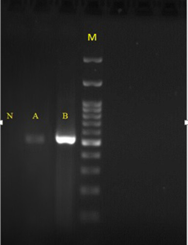 Figure 4 Agarose-gel electrophoresis of ß-tubulin PCR products. Lane N, negative control; lane A, DNA extracted from negative blood culture; lane B DNA extracted from colonies grown on SDA; lane M, 100,bp DNA size marker.