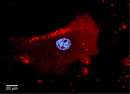 Fig. 1.  CMs stained with CellTracker™ Red were washed and cultured in serum free media for 48 hours. EVs were isolated from media using ultracentrifugation and visualized being taken up by cardiac fibroblasts using an Olympus BX62 microscope with Qimaging EMc2 EMCCD cooled camera (red, cell tracker red for membrane; blue, hoechst 33,342 for nucleus).