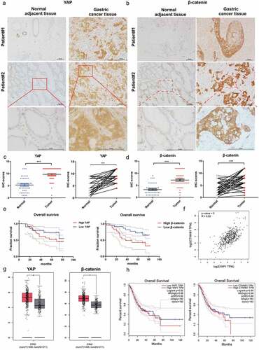 Figure 7. Elevated YAP was positively correlated with β-catenin expression in gastric cancer. (a, b) Representative immunohistochemical staining of YAP and β-catenin (b) in human gastric carcinoma and adjacent normal tissues. (Magnification 100× and 400×, Scale bars: 25 μm) (c, d) Immunohistochemistry staining scores for YAP (c) and β-catenin (d) (n = 48). ***, P < 0.001. (e) Kaplan‒Meier survival analysis for the low expression and high expression of YAP or β-catenin. (f) Spearman’s correlation between IHC staining scores of YAP and β-catenin in human gastric cancer tissues. (g) the expression of YAP and β-catenin in patients with stomach cancer from the GEPIA database. *, P < 0.05. (h) the overall survival analysis for low and high expression of YAP or β-catenin based on the GEPIA database.