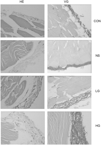 Figure 2. Pathological variation of peritoneal tissue in PD rats (HE staining and VG staining, ×400).