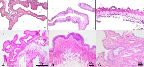 Figure 12 Photomicrographs showing inner buccal mucosa (H&E staining). (A) NOHAL solution, (B) negative control, (C) positive control.