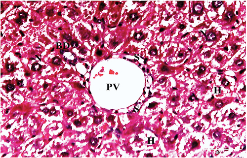 Figure 8. A photomicrograph of a liver section of HCC animals treated with IQ (10 mg/kg bw) showing portal vein (PV) with bile ductule (BD). The portal vein is surrounded by sinusoids (S) and hepatocytes (H) with vacuolated cytoplasm and central rounded nuclei (N) (H&E x400).