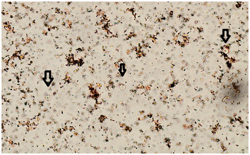 Figure 1. Cryptosporidium in D’Antonis stained wet mount of ethyl-acetate concentrated faecal sample (Black arrows). 400× magnification.