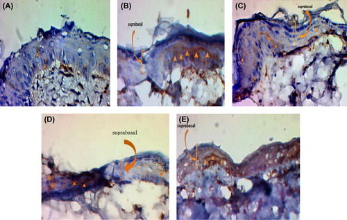 Figure 6. Immunostaining or epidermal markers expression (cytokeratin-10) on day 21. A) The un-modified nanofibrous scaffold without USSCs. B) The un-modified nanofibrous scaffold with USSCs. C) The collagen-coated nanofibrous scaffold without USSCs. D) The collagen-coated nanofibrous scaffold with USSCs. E) The normal skin. Scale bars: 50 μm.