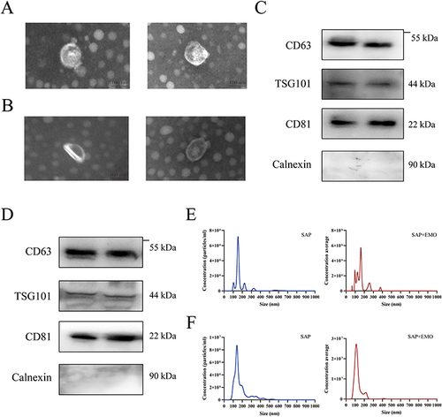 Figure 3 Characterization of exosomes derived from plasma and BALF. Observation of exosomes derived from plasma (A) and BALF (B) by transmission electron microscopy. Western blot detection of positive protein CD63, TSG101, CD81, and negative protein Calnexin in exosomes derived from plasma (C) and BALF (D). Size and concentration of exosomes derived from plasma (E) and BALF (F) by nanoparticle tracking analysis. bar: 100 nm.