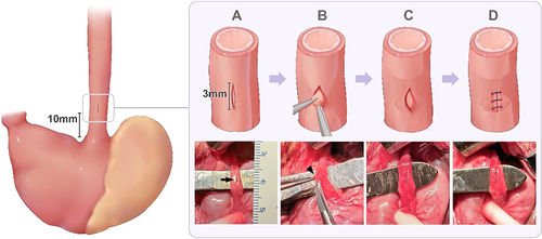 Figure 1 The process of developing the rat model to simulate benign esophageal stricture induced by endoscopic submucosal dissection. (A) The distal esophagus was separated via a median abdominal incision, and a 3-mm incision (black arrow) was made in the muscularis propria of the distal esophagus. The incision was located 10 mm from the esophagogastric junction. (B–C) The mucosa (black arrowhead) underlying the muscularis propria was pulled out, and a 3/4 circumferential mucosal resection (length: 5 mm) was performed. (D) The incision on the muscularis propria was closed by continuous suturing using 7–0 absorbable sutures.