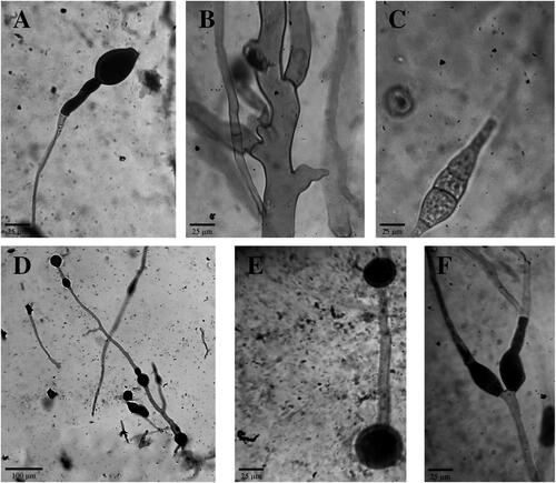 Figure 3. Microscopic features of Ragi tapai isolates. (A) oval abortive sporangia with enlarged apophyses SMD (400x); (B) Coenocytic hypha YOG (400x); (C) Zygospore YOG (400x); (D) Chlamydospores BLR (100x); (E) Intercalary chlamydospores BDS (400x); (F) Y-shaped spore-like bodies BLR (400x).