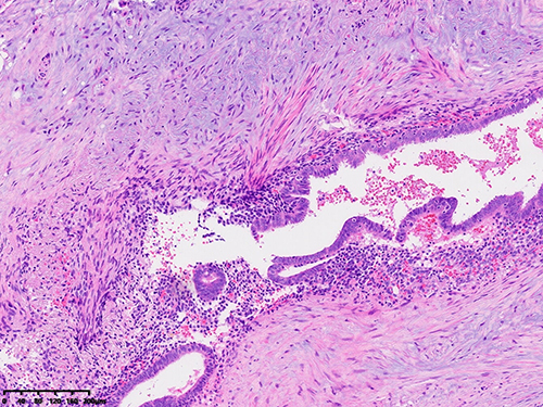 Figure 7 Histopathological analysis following partial intestinal resection.