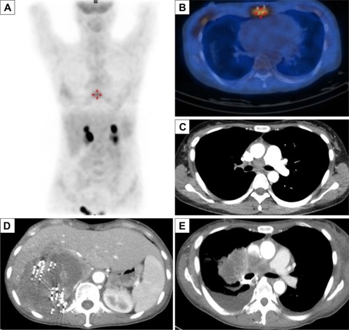 Figure 3 Images of the tumors.