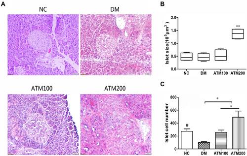 Figure 5 Effect of ATM on Islet morphology in db/db mice as compared with responses in controls (NC). (A) HE staining of the Islet. (n = 6). Original magnification 200 ×. (B) Quantification of islet size in sections from mice pancreas. Boxes and whiskers are shown, 10–90% confidence intervals. (C) Number of islet cells. #Means NC vs DM group p<0.05; *indicatesATM (at 100 or 200 mg/kg in DM) vs DM group p<0.05; **indicates ATM (at100 or 200 mg/kg in DM) vs DM group p<0.01.