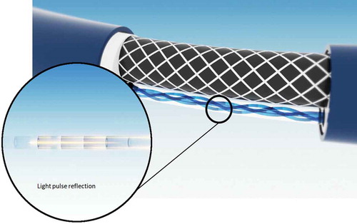 Figure 2. Incorporation of hair-thin optical fibers into a catheter (courtesy of Philips Medical Systems Nederland, Best, The Netherlands).