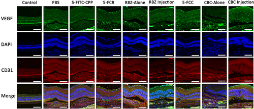 Figure 9 Double immunostainings with endothelial marker CD31 and VEGF in the retina/choroid cryosections were performed in nine groups and images were recorded by fluorescence microscope. Scale bar: 100 µm.