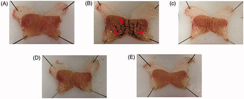 Figure 2. Effect of HemoHIM on stomach appearance in indomethacin-induced rat. Arrow heads indicate reddening and hemorrhage.(A) Control (B) Indomethacin (C) HemoHIM 250 mg kg−1 (D) HemoHIM 500 mg kg−1 (E) Cimetidine 100 mg kg−1.